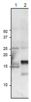 Fd3 | Ferredoxin 3 in the group Antibodies Plant/Algal  / Photosynthesis  / Electron transfer at Agrisera AB (Antibodies for research) (AS20 4432)